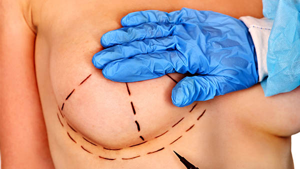 augmentation mammaire douleur combien de temps