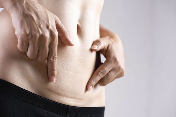 chirurgie réparatrice cicatrice